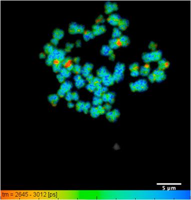 Combining Multicolor FISH with Fluorescence Lifetime Imaging for Chromosomal Identification and Chromosomal Sub Structure Investigation